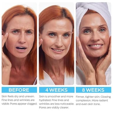 Retinol Cream for Face with Hyaluronic Acid, Day-Night Anti-Aging Moisturizer for Women, Men, Collagen Cream for Face Reduces Wrinkles, Dryness, 1.85 Oz - Image 7