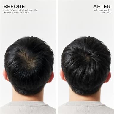 Dr. Groot Hair Thickening Shampoo, Korean Hair Care with Biotin, Rosemary Oil to Help Volumize Thinning, Damaged Hair, Hydrate Hair and Scalp, Biotin Shampoo, Scalp Revitalizing Solution - Image 4