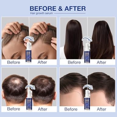 VENANOCI Hair Growth Oil Spray: with Rosemary, Biotin, Batana Oil & Rice Water – Natural Anti-Hair Loss Treatment for Thinning Hair – Promotes Thicker, Fuller Hair for Women & Men – All Hair Types - Image 2