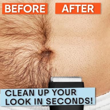 Meridian Ball Trimmer Men Body Hair Trimmer for Men and Women Hair and Beard Trimmer for Men and Women Beard and Body Trimmer for Men and Women Bikini Trimmer Onyx - Image 3