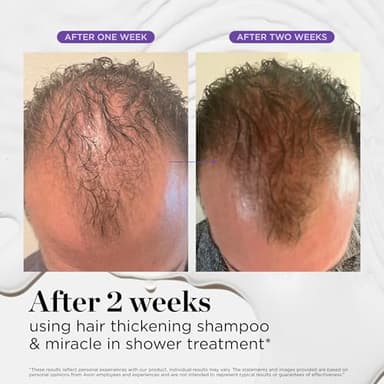 Dr. Groot Miracle in Shower Treatment, Korean Hair Care, 5 Seconds to Smooth Hair, Rosemary Oil for Healthier-Looking Hair, Hair Rinse, Moisturizing Hair Treatment, Kbeauty Scalp Revitalizing Solution - Image 8