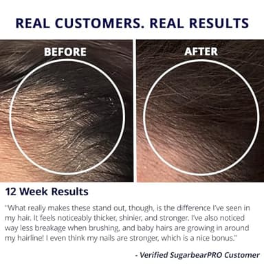 Sugarbear Hair Vitamin Gummy 2 Month Supply Extra Strength Biotin 6000mcg, Growth for Men & Women, Vegan Vitamin B12, MSM, Inositol, Omega 3, Elderberry, Certified Kosher, Halal, Cruelty-Free - Image 5