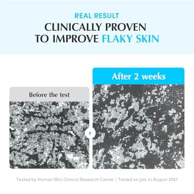 EQQUALBERRY Swimming Pool Toner - Korean Toner for Daily Exfoliating & Deep Hydration with Natural Enzyme Protease & Hyaluronic Acid, For Sensitive Skin, 10.14 Fl Oz (300ml) - Image 8