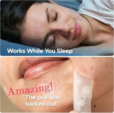 LitBear Large Pimple Patches, 5 Sizes 156 Patches Big Acne Patch, 60 XL Hydrocolloid Patch for Full Face, Forehead, Chin, Nose, Body, Back, Neck & Chest, Stirp, Square Large Hydrocolloid Bandages - Image 5