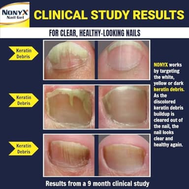 NONYX Fungal Nail Clarifying Gel | Clinically Proven for Discolored, Thick, Brittle, Yellow, Lifted, and other signs of Fungus-Damaged Toenails | 90% of Nails Improve | Over 8 million sold - Image 3