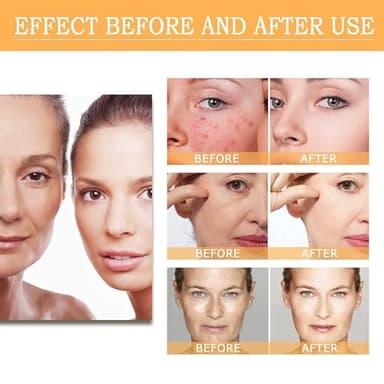 Ordinary Glycolic Acid Toning Solution, 8 Fl Oz Glycolic Acid 7% Toner Gently Exfoliates, Smooths Skin Texture, Improvement Visible Clarity & Also Addressing Uneven Tone, Reveal Radiant Skin - Image 6