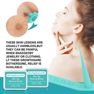 Skin Tag Remover, FDA-Cleared Skin Tag Removal Kit Device, Safe and Effective Home Use (Yellow) - Image 6