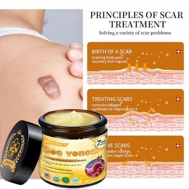 APKAPK Bee venom comprehensive Cream, Bee Venom Skin Treatment Cream,Deeply nourishes the skin and reduces skin blemishes (2PCS) - Image 4