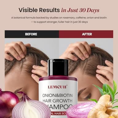 Onion & Biotin Hair Growth Shampoo: Infused With Natural Rosemary Tea Tree Anti Hair Loss Shampoo - Scalp Smooths Thickening Formula Support Hair Regrowth For Women Men 12.5Fl Oz - Image 3