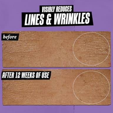 Kiehl's Daily Micro-Dose Anti-Aging Retinol Facial Serum, Reduces Wrinkles, Firms Skin, Evens Skin Tone, Youth Renewing & Hydrating Formula, with Retinol & Ceramides, Paraben-free - 1.7 fl oz - Image 6