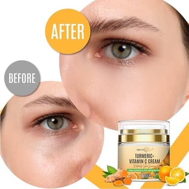 Turmeric Face Cream + 30% Vitamin C Glow Boosting Moisturizer & Skin Repairing, Hydrating with Organic Ingredients Anti-Aging Facial Cream, Normal, Dry, Oily & Combination Skin - 1.7 FL OZ - Image 4