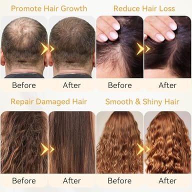 ABOUSHE Raw Batana Oil for Hair Growth - 100% Pure, Organic Dr. Sebi Batana Hair Mask from Honduras - Unrefined Hair Growth Oil for Thicker, Stronger Hair, Prevents Hair Loss for Women & Men 4.2 OZ - Image 2