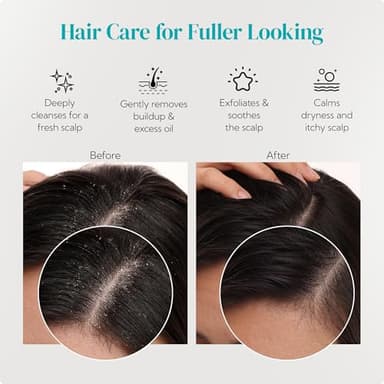 HEETA Hair Scalp Massager Shampoo Brush 2 Pack, Soft Silicone Bristles to Remove Dandruff, Waterproof Hair Scrubber for Both Wet Dry Hair, Suitable for Men & Women (Green & Black) - Image 7