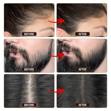 VOLLUCK Root Touch up Powder, Instant Hairline Powder for Thinning Areas and Gray Hair Coverage, Natural and Non-greasy Root Cover up for Women and Men (Dark Brown, 0.35 Ounce) - Image 5