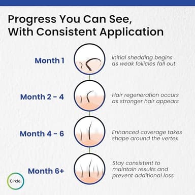 Minoxidil for Men Foam 5% - Unscented 3 Month Supply - Helps Restore Vertex Hair Loss & Thinning - 5% Minoxidil Foam For Men - Extra Strength Supports Hair Regrowth - Image 6