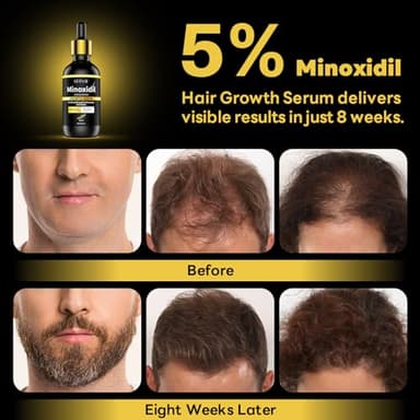 5% Minoxidil with Rosemary for Men and Women Hair Growth,Beard Growth Kit,Scalp Serum for Thicker Fuller Hair - Image 4