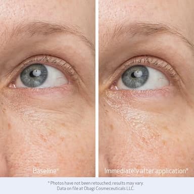 Obagi Daily Hydro-Drops Rejuvenating Eye Gel Cream – Reduces the Appearance of Dark Circles & Instantly Brightens, Smooths, & Depuffs Eyes – 0.5 oz - Image 5