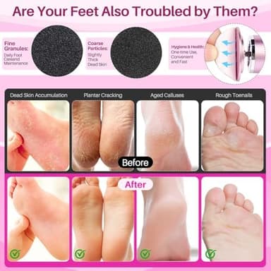 LIONVISON Electric Foot Callus Remover: Adjustable Speed Foot File for Cracked Heels - Working Women's Summer Pedicure Tool with 60pcs Sandpaper Discs - Dead Skin Remover for Dry Feet at-Home - Image 5