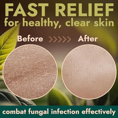 Terramed Just Think Comfort Antifungal & Antibacterial Soap & Body Wash with Tea Tree Oil | Treats Ringworm, Back Acne, Eczema & Jock Itch | Antibacterial Body Soap For Men And Women (16.9 oz) - Image 4