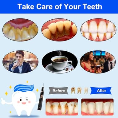 Plaque Remover for Teeth, Tartar Remover for Teeth Cleaning with 4 Replaceable Heads and 3 Adjustable Modes, Rechargeable Teeth Cleaning Plaque Remover for Home - Image 5