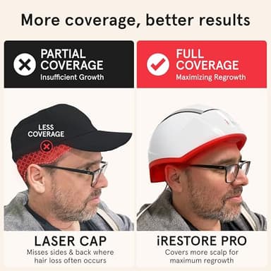 iRestore Professional Laser Red Light Therapy for Hair Growth System - FDA Cleared Hair Loss, Hair Thinning & Alopecia Treatment for Men & Women - 282 Lasers & LEDs - Image 3