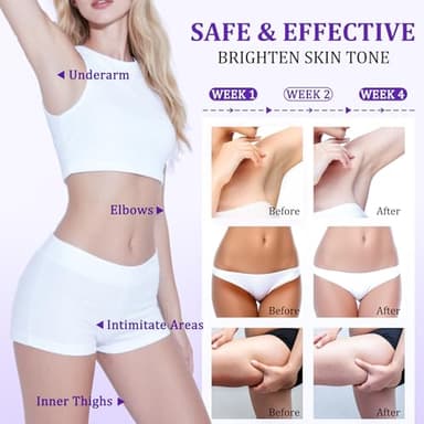 Dark Spot Remover for Body, Skin Bleaching Cream with Vitamin C for Intimate Areas, Skin Lightening Cream Dark Spot Corrector for Underarms, Knees, Elbows, Inner Thighs & Bikini Line,1.7fl oz - Image 6