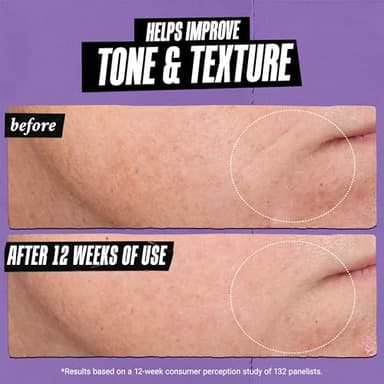 Kiehl's Daily Micro-Dose Anti-Aging Retinol Facial Serum, Reduces Wrinkles, Firms Skin, Evens Skin Tone, Youth Renewing & Hydrating Formula, with Retinol & Ceramides, Paraben-free - 1.7 fl oz - Image 7