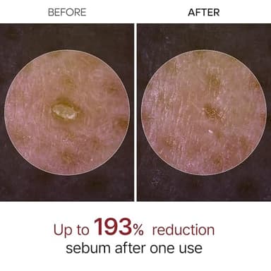 Peel Shot Glow Rice Ampoule Duo White rice ampoule+Black rice ampoule Soft Exfoliating Face and Body Scrub Dead Skin Cells, Blackheads Remover for All Skin Types - Image 3