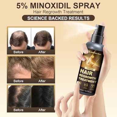 Minoxidil Spray - 5% Minoxidil for Men, Minoxidil for Women Hair Growth Products, Extra Strength Hair Regrowth Treatments with Biotin, Help to Stop Loss Hair Unscented Light and non Greasy 3.38 Fl.OZ - Image 2