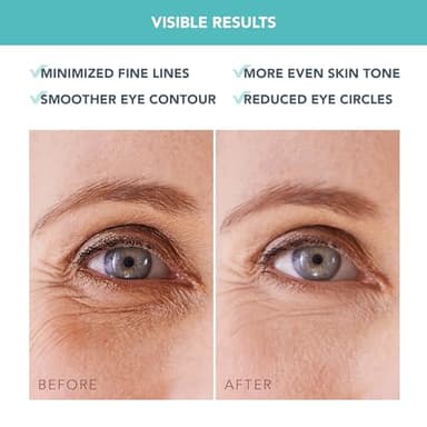 FOREO Eye Revive IRIS 2 Bundle - Lymphatic Drainage Eye Massager IRIS Hydrating Hydrogel Eye Mask, 60 pcs Dark Eye Circle Remover & Eye Bags Remover - Eye Puffiness Reducer - Fuchsia - Image 8