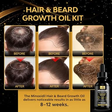 Minoxidil for Men, Minoxidil for Men Beard Growth Kit, Minoxidil for Women Hair Growth Kit, Hair Regrowth for Men, Beard Growth Serum, Minoxidil 5 Percent (Black) - Image 2