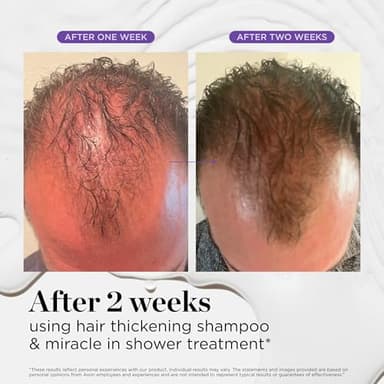 Dr. Groot Hair Thickening Shampoo, Korean Hair Care with Biotin, Rosemary Oil to Help Volumize Thinning, Damaged Hair, Hydrate Hair and Scalp, Biotin Shampoo, Scalp Revitalizing Solution - Image 6