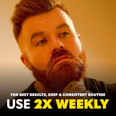 The Beard Club Derma Roller for Face, Body and Scalp - Microneedling for Men and Women with 540 Titanium Microneedles - Beard Roller & Micro Needling Scalp Hair - Black - Image 5