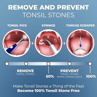 ORAVIX Tonsil Stone Remover - Tonsil Stone Removal Kit - Tonsillolith Remover Tool - Tonsil Cleaner - Fight Bad Breath - Tonsil Stone Removal Tool - Oral Irrigator - Tongue Scraper - 7 Pieces - Image 2