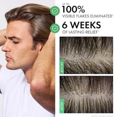 Dercos Anti Dandruff Shampoo, Dry Scalp Treatment and Itch Relief. Prescription Strength Comparable to 2% Ketoconazole, for Mild to Severe Dandruff-Prone Hair & Flaky, Itchy Scalps, 13.5 Fl. Oz. - Image 4