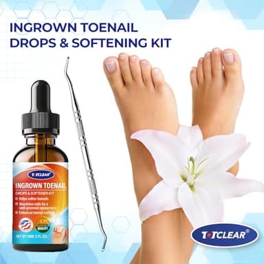 Ingrown Toenail Relief: Ingrown Toenail Tool for Men Women - Ingrown Toenail Removal Kit - Ingrown Toenail Corrector Drops - Ingrown Toenail Removal - Effective Solution for Ingrown Toenails - 30ml - Image 7