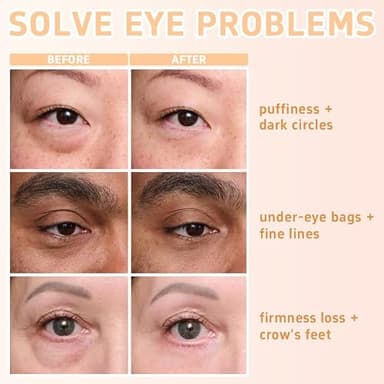 Perfection Eye Tightener - Instant Firming Primer with Hyaluronic Acid & Vitamin E | Hydrating Lift for Tired Eyes, Smooth Finish & 24H Refresh (0.67oz) - Image 6