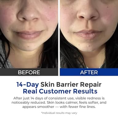SKINERSE Intensive Repair Serum, 15%Hyaluronic Acid for Sensitive Skin Anti Aging Ultra Hydrating Serum for Face Calming Barrier Repair Redness Relief with Ceramides Centella 30Vials Daily Travel Care - Image 3