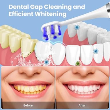 UNINGOPI Portable Water flosser with Electric Toothbrush, 2 in 1 Teeth Cleaning Kit, Electric Toothbrush and flosser Combo, Water Flosser for Travel and Home (White) - Image 2