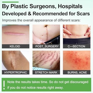 Silicone Scar Sheets (1.6” x 120” Roll-3M), Silicone Scar Tape Roll, Scar Silicone Strips, Reusable, Professional Scar Removal Sheets for C-Section, Surgery, Burn, Keloid, Acne et - Image 10