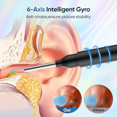 Ear Wax Removal Tool Camera with 8 Kits & 5 Ear Spoon, Ear Cleaner with Camera 1080P HD, Earwax Removal Kit with 6 LED Lights, Ear Wax Removal Kit for iOS & Android - Image 3