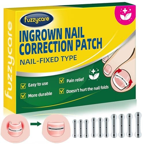 Large Size-Titanium Alloy Ingrown Toenail Treatment & Removal Kit for Quick Relief, Ingrown Toenail Removal Kit, Professional Ingrown Toenail Corrector, Ingrown Toenail Tools for Quick Relief, 10 Pcs - Image 1