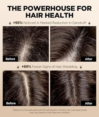 100% Pure Jamaican Black Castor Oil for Hair & Skin, Cold Pressed Organic Hair Growth Oil for Eyelashes & Eyebrows, Unrefined Hair Oil Glass Bottle Pack Wrap Christmas Gift, Hexane Free 2.02 Fl Oz - Image 3