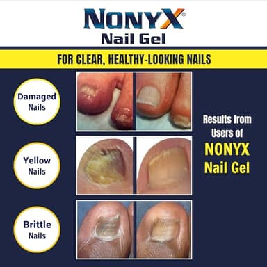 NONYX Fungal Nail Clarifying Gel | Clinically Proven for Discolored, Thick, Brittle, Yellow, Lifted, and other signs of Fungus-Damaged Toenails | 90% of Nails Improve | Over 8 million sold - Image 5
