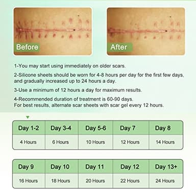 Silicone Scar Sheets (1.6” x 120” Roll-3M), Silicone Scar Tape Roll, Scar Silicone Strips, Reusable, Professional Scar Removal Sheets for C-Section, Surgery, Burn, Keloid, Acne et - Image 6