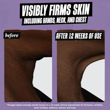 Kiehl's Daily Micro-Dose Anti-Aging Retinol Facial Serum, Reduces Wrinkles, Firms Skin, Evens Skin Tone, Youth Renewing & Hydrating Formula, with Retinol & Ceramides, Paraben-free - 1.7 fl oz - Image 8