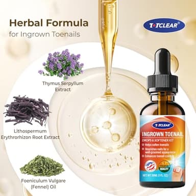 Ingrown Toenail Relief: Ingrown Toenail Tool for Men Women - Ingrown Toenail Removal Kit - Ingrown Toenail Corrector Drops - Ingrown Toenail Removal - Effective Solution for Ingrown Toenails - 30ml - Image 3