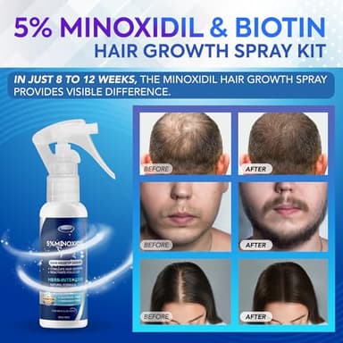 5% Minoxidil for Men, Minoxidil Spray, Minoxidil for Women Hair Growth, Minoxidil for Men Beard Growth, Hair Regrowth for Men, Minoxidil 5 Percent, Hair Loss Treatments for Women 60ml * 3bottles - Image 2
