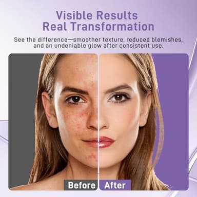 Lovsheme LED Face Mask Light Therapy - Professional Grade Skincare at Home – Red Light Therapy for Face for Acne, Wrinkles, Skin Rejuvenation – 3 Light Modes - Remote Control - includes Eye Protection - Image 6