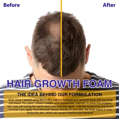 5% Minoxidil Foam for Hair Growth and Thickening - Biotin & Minoxidil Treatment to Stop Thinning & Hair Loss for Men & Women, 2oz - Image 7